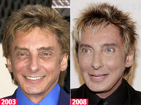 Plastic Surgery Gone Wrong Photos. plastic surgery gone bad.